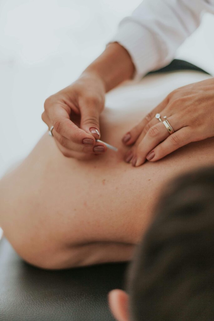 Dry Needling Physio Dandenong South VIC Australia